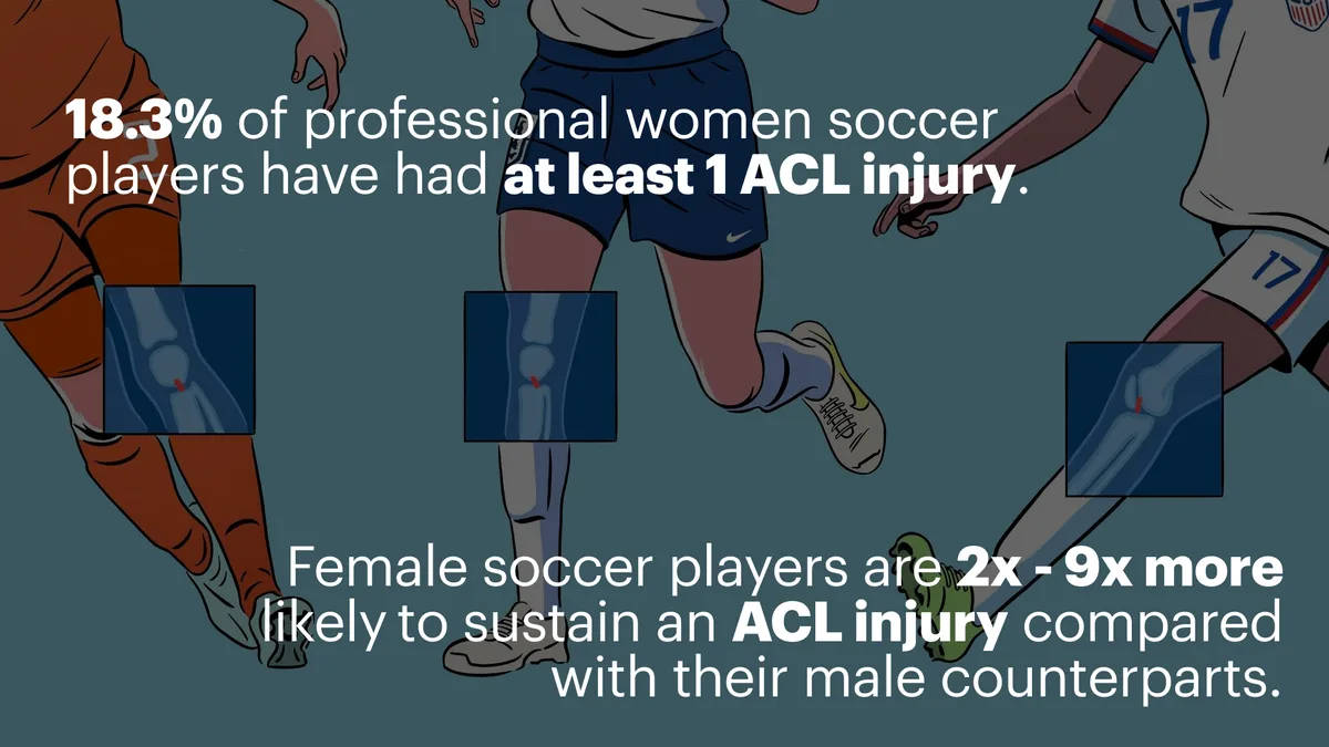 Illustration of the reasons why female soccer players are more likely to suffer ACL injury
